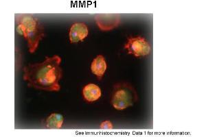 Image no. 3 for anti-Matrix Metallopeptidase 1 (Interstitial Collagenase) (MMP1) (N-Term) antibody (ABIN2777119)