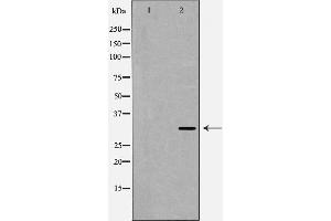 Image no. 2 for anti-Tumor Necrosis Factor-Inducible Protein 6 (TNFAIP6) antibody (ABIN6265768)