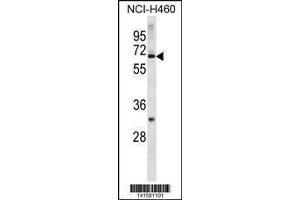 Image no. 1 for anti-Zinc Finger Protein 185 (ZNF185) (AA 155-183), (N-Term) antibody (ABIN1882016)