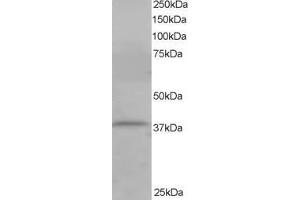 Image no. 2 for anti-Cytohesin 1 Interacting Protein (CYTIP) (N-Term) antibody (ABIN184711)