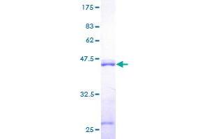Calmodulin 2 (phosphorylase Kinase, Delta) (Calm2) (AA 1-149) protein (GST tag)