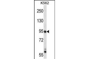 Image no. 1 for anti-Mitogen-Activated Protein Kinase Kinase Kinase 10 (MAP3K10) (AA 110-138), (N-Term) antibody (ABIN5537074)