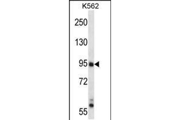 anti-Mitogen-Activated Protein Kinase Kinase Kinase 10 (MAP3K10) (AA 110-138), (N-Term) antibody