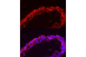 Immunofluorescence analysis of human testis cells using SP Rabbit pAb (ABIN3022967, ABIN3022968, ABIN1513554 and ABIN6219322) at dilution of 1:150 (40x lens).