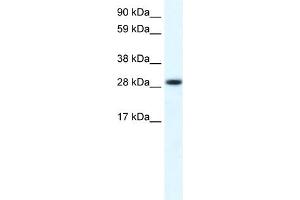 FHL1 antibody  (C-Term)