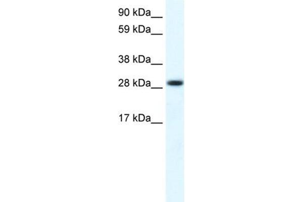 FHL1 antibody  (C-Term)