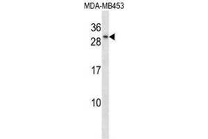 Image no. 1 for anti-TGFB-Induced Factor Homeobox 2 (TGIF2) (AA 170-199), (C-Term) antibody (ABIN955180)