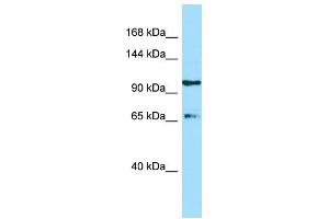 Image no. 1 for anti-ESF1, Nucleolar Pre-rRNA Processing Protein, Homolog (ESF1) (C-Term) antibody (ABIN2774448)
