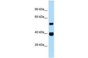 Image no. 1 for anti-Ankyrin Repeat and SOCS Box Containing 4 (ASB4) (AA 191-240) antibody (ABIN6747354)