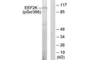 Western blot analysis of extracts from HeLa cells treated with serum 10 % 15', using eEF2K (Phospho-Ser366) Antibody.