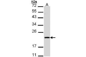 Image no. 1 for anti-Second Mitochondria-Derived Activator of Caspase (DIABLO) (Center) antibody (ABIN2856427)