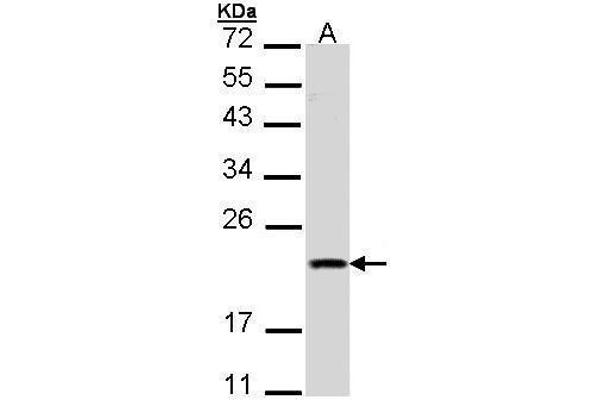 anti-Second Mitochondria-Derived Activator of Caspase (DIABLO) (Center) antibody