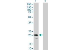 Image no. 1 for anti-Glycophorin C (GYPC) (AA 1-128) antibody (ABIN516311)