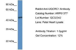 Image no. 1 for anti-Ubiquinol-Cytochrome C Reductase Core Protein I (UQCRC1) (N-Term) antibody (ABIN2788783)