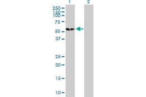 Image no. 1 for anti-Calcium/calmodulin-Dependent Protein Kinase IV (CAMK4) (AA 1-473) antibody (ABIN513965)