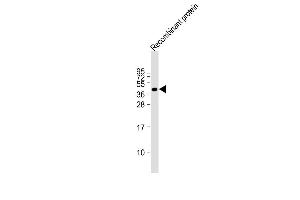 Image no. 1 for anti-FAT Tumor Suppressor Homolog 4 (FAT4) antibody (ABIN4909466)