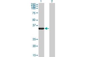 Western Blot analysis of HAX1 expression in transfected 293T cell line by HAX1 monoclonal antibody (M04), clone 1D2.