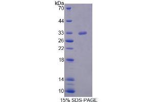 Image no. 1 for serine/threonine Kinase 11 (STK11) (AA 49-309) protein (His tag) (ABIN6237533)