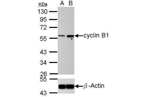 Cyclin B1 抗体  (Center)