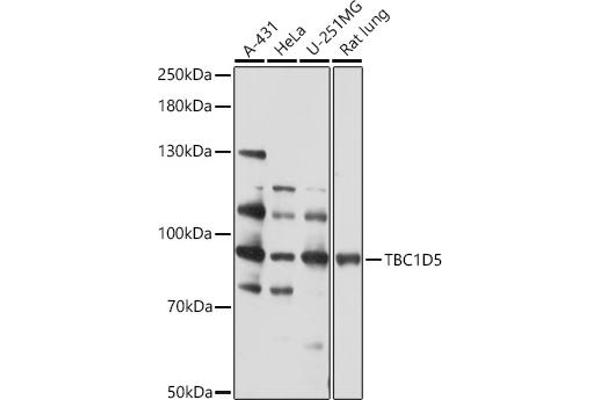 TBC1D5 抗体  (AA 446-795)