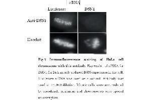 Image no. 4 for anti-Kinetochore-associated protein DSN1 homolog (DSN1) (N-Term) antibody (ABIN2451961)