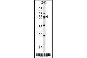 Image no. 2 for anti-Small ArfGAP2 (SMAP2) (Center) antibody (ABIN2503095)