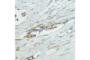 SOCS5 antibody  (AA 1-140)