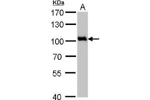 Image no. 1 for anti-Valosin Containing Protein (VCP) (N-Term) antibody (ABIN2856882)