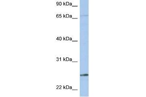 Image no. 3 for anti-Kallikrein 6 (KLK6) (N-Term) antibody (ABIN2778179)