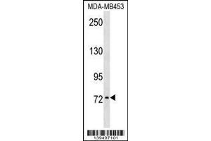 Image no. 1 for anti-Kallmann Syndrome 1 Sequence (KAL1) (AA 166-194), (N-Term) antibody (ABIN1539108)