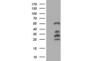 Image no. 7 for anti-Interferon Regulatory Factor 6 (IRF6) antibody (ABIN1498901)