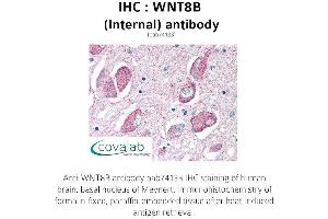 Image no. 1 for anti-Wingless-Type MMTV Integration Site Family, Member 8B (WNT8B) (Internal Region) antibody (ABIN1740842)