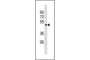Image no. 1 for anti-Zinc Finger and BTB Domain Containing 8A (ZBTB8A) (AA 205-232) antibody (ABIN1882004)