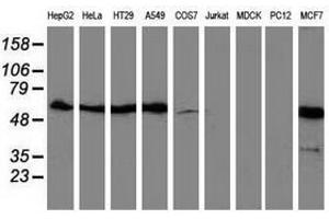 Image no. 2 for anti-Sequestosome 1 (SQSTM1) antibody (ABIN1499989)