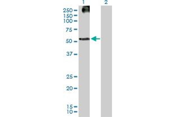 KRT83 antibody  (AA 1-493)