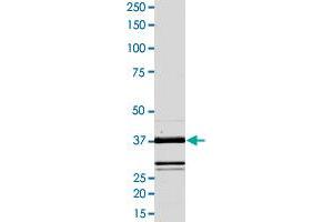 Image no. 2 for V-Raf-1 Murine Leukemia Viral Oncogene Homolog 1 (RAF1) (AA 306-648), (Tyr340Asp-Mutant), (Tyr341Asp-Mutant) protein (ABIN5569962)