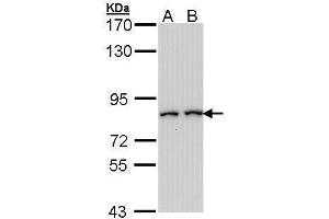 WB Image Sample (30 ug of whole cell lysate) A: Hep G2 , B: Molt-4 , 7.