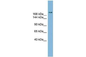 Image no. 1 for anti-SET Binding Protein 1 (SETBP1) (Middle Region) antibody (ABIN2780976)