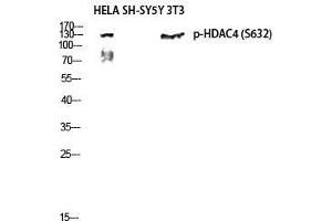 Image no. 2 for anti-Histone Deacetylase 4 (HDAC4) (pSer632) antibody (ABIN3182024)