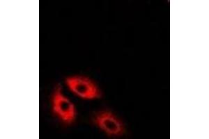 Image no. 1 for anti-Malate Dehydrogenase 2, NAD (Mitochondrial) (MDH2) antibody (ABIN2966797)