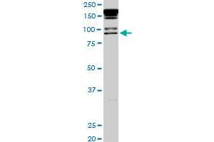 Image no. 4 for anti-Promyelocytic Leukemia (PML) (AA 411-510) antibody (ABIN562289)
