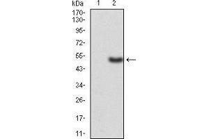 Image no. 4 for anti-Adducin 1 (Alpha) (ADD1) (AA 1-193) antibody (ABIN5542416)