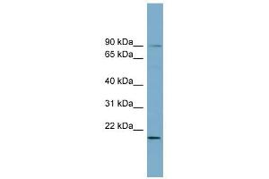 Image no. 1 for anti-UFM1-Specific Ligase 1 (UFL1) (Middle Region) antibody (ABIN632366)