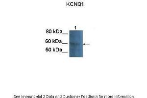 Image no. 3 for anti-Potassium Voltage-Gated Channel, KQT-Like Subfamily, Member 1 (KCNQ1) (N-Term) antibody (ABIN2776085)