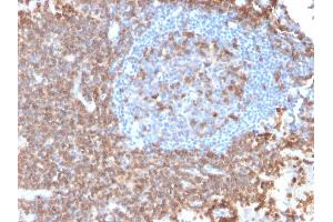 Recombinant CD43 antibody