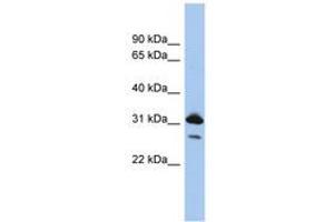 Image no. 1 for anti-RAP1B, Member of RAS Oncogene Family (RAP1B) (N-Term) antibody (ABIN6744003)