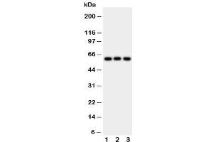 Image no. 3 for anti-Hexosaminidase A (HEXA) (Middle Region) antibody (ABIN3031197)