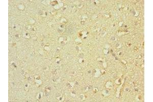 Immunohistochemistry of paraffin-embedded human brain tissue using ABIN7161335 at dilution of 1:100