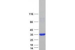 Image no. 1 for phosphoribosyl Pyrophosphate Synthetase 2 (PRPS2) (Transcript Variant 1) protein (Myc-DYKDDDDK Tag) (ABIN2729835)