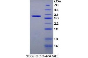 Image no. 1 for Chondroitin Sulfate Proteoglycan 5 (Neuroglycan C) (CSPG5) (AA 139-370) protein (His tag) (ABIN1879113)